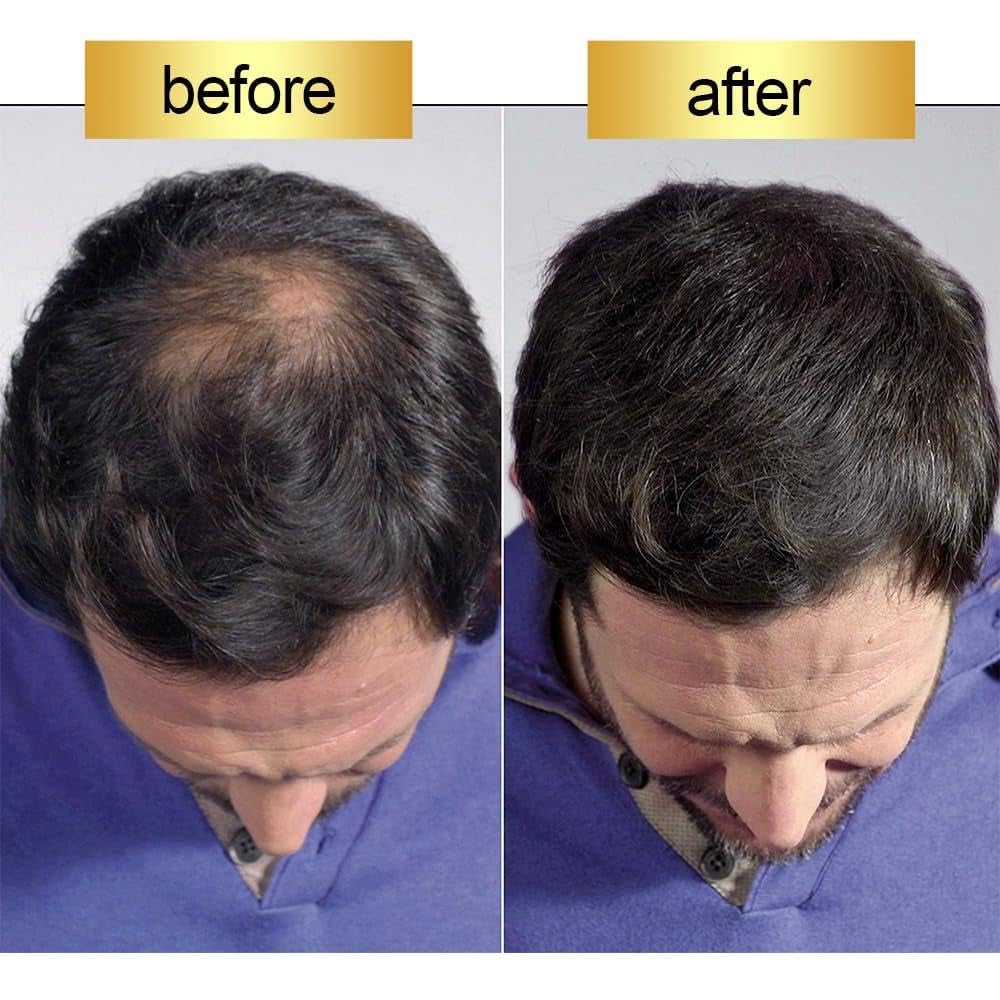 Hair Building Fibers Black 27.5G (0.97 Oz), Fill in Fine or Thinning Hair Instantly Thicker, Fuller-Looking Hair, Hair Thickening Fibers for Men & Women